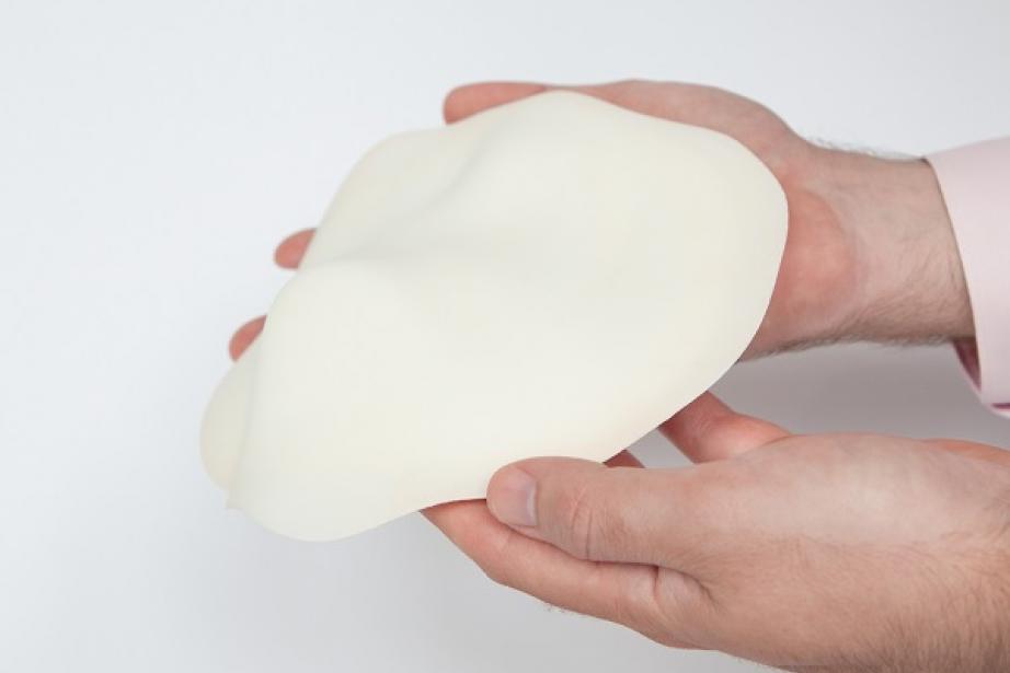 A partir d'un moule sur mesure fabriqué en impression 3D, on réalise l'implant en silicone personnalisé