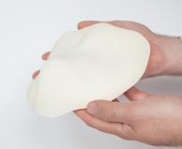 A partir d'un moule sur mesure fabriqué en impression 3D, on réalise l'implant en silicone personnalisé