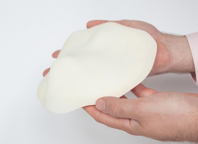A partir d'un moule sur mesure fabriqué en impression 3D, on réalise l'implant en silicone personnalisé