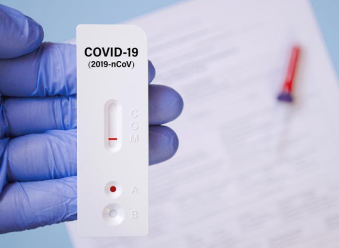 Un test antigénique pour la Covid-19